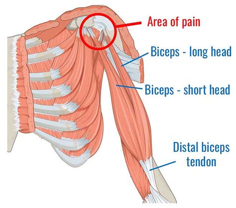 Can You Get Tendonitis From Driving: Exploring The Risks