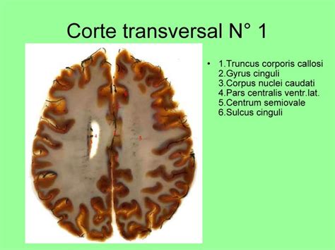 corte transversal de encefalo