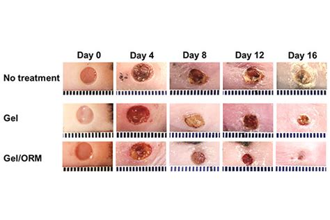 Oxygen-delivering hydrogel accelerates diabetic wound healing