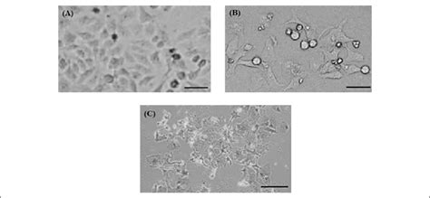 Alteration in morphology of human hepatocarcinoma (HepG2) cells. A,... | Download Scientific Diagram