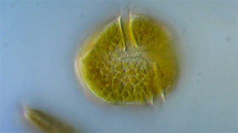 Dinoflagellates Under Microscope Labeled