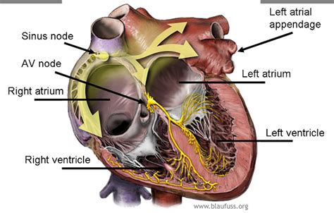 HEALTH FROM TRUSTED SOURCES: Implantable cardioverter-defibrillators (ICDs)