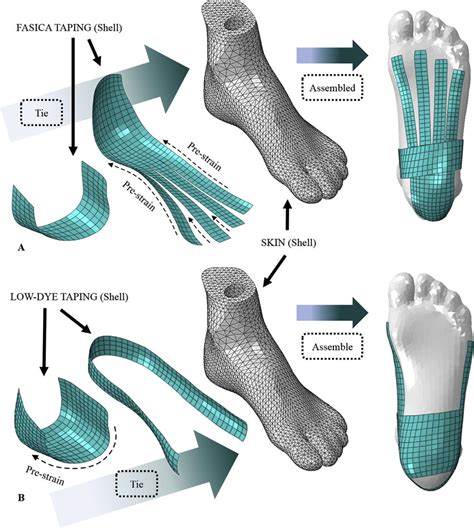 (A) Modelling of Fascia taping in the simulations; (B) modelling of ...