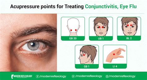 Acupressure Points for Treating Eye-Flu - Modern Reflexology