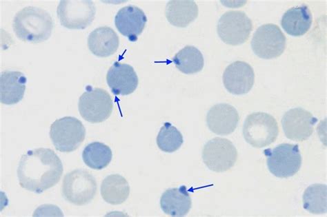 Reticulocyte Vs Heinz Body