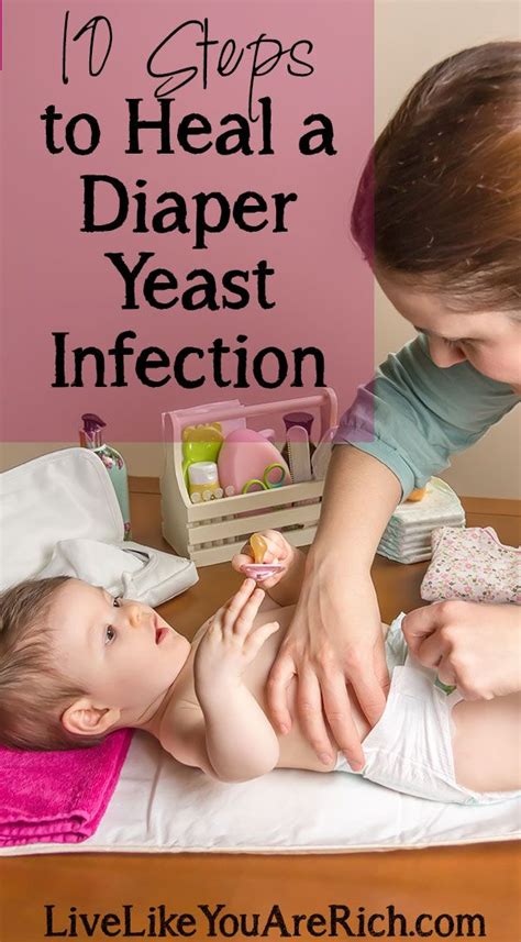 How to Cure Diaper Yeast Infections | Bad diaper rash, Yeast diaper rash, Baby rash