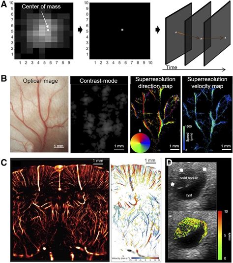 Advanced Ultrasound Technologies for Diagnosis and Therapy | Journal of ...