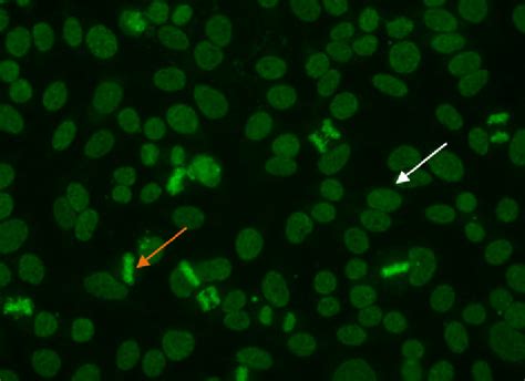 Dense fine speckled pattern. Mitotic cells (orange arrow) show a fine ...