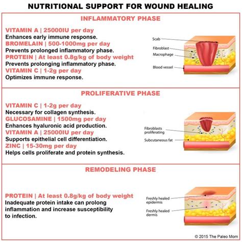 Nutritional Support for Injury and Wound Healing | Dental health, Wound healing, Dental health care