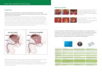 Medical lasers for BPH surgery, Urology - GIGAALASER - PDF Catalogs ...