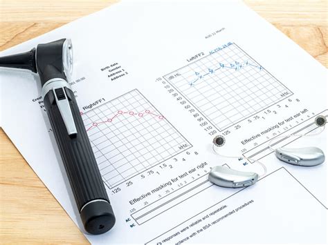 Hearing Test Audiograms and How to Interpret Them