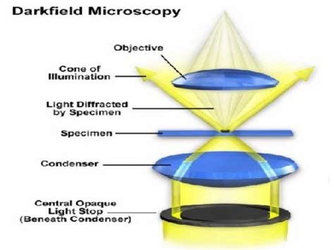 Dark field microscopy (1) By Ehtisham Ul Haq