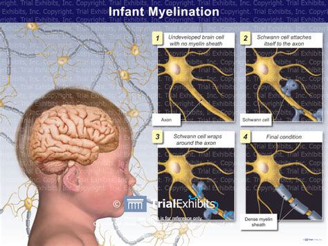 Infant Myelination - TrialQuest Inc.