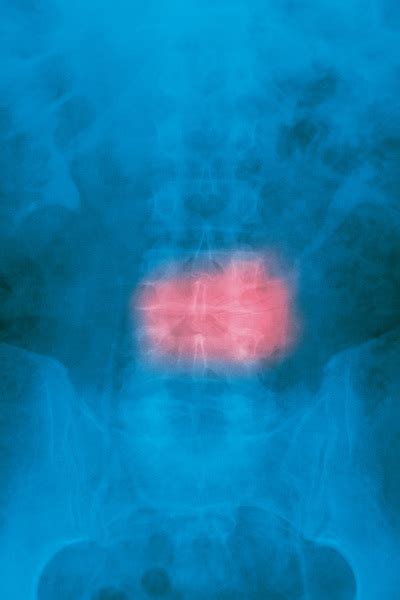 X-ray of back Free Photo Download | FreeImages