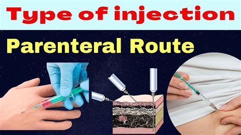 Parenteral route | drug administration | type of injection | pharmacology | route of ...