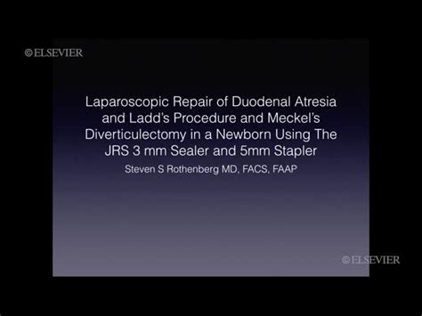 Laparoscopic repair of duodenal atresia, Ladd procedure and meckel diverticulectomy - Pediatric ...