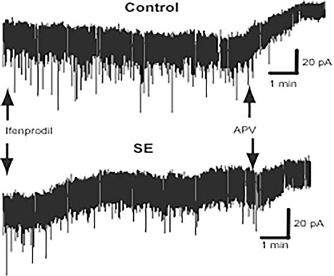 Tonic excitation mediated by N2B subunit‐containing NMDA receptors ...