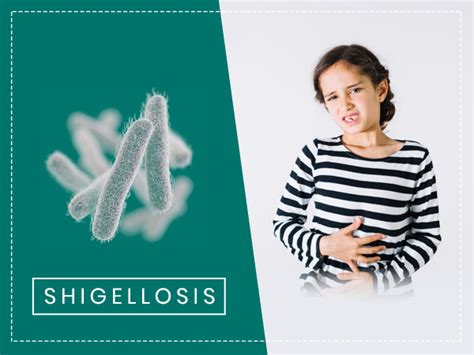 Shigella Infection: Symptoms, Causes, Complications, Diagnosis And ...