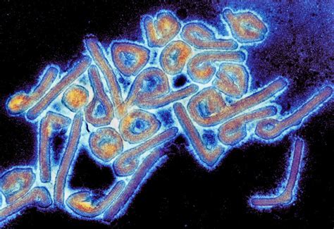 Micrograph of the Marburg Viru [IMAGE] | EurekAlert! Science News Releases