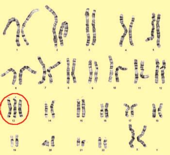 Changes in Chromosome Number – Mt Hood Community College Biology 102