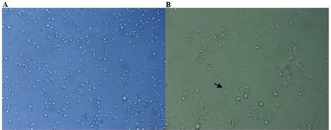 Mature dendritic cells in suspension under an inverted microscope at ...