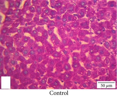 PAS stain of liver: (a) control group and (b) NSO- (2 mL/kg) treated... | Download Scientific ...