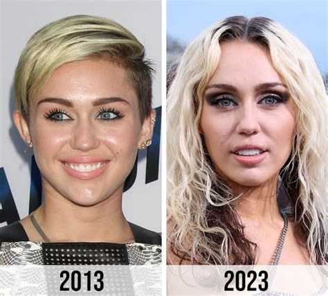 Miley Cyrus Fans Speculate She Had 'Plastic Surgery' After Seeing ...