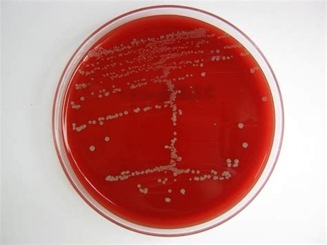 Fusobacterium nucleatum | mostly*harmless | Flickr