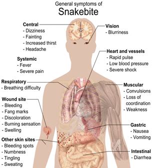 Symptoms of snake bite | Download Scientific Diagram