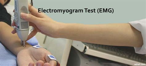 The Role of Electromyogram (EMG) Test for Muscle Disorders |Sehat