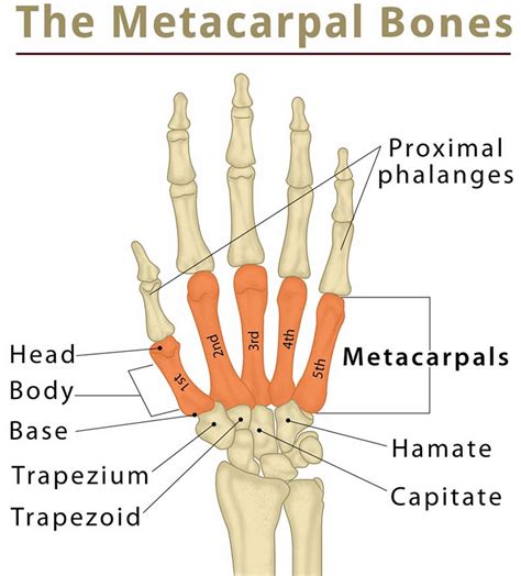 Metacarpal fracture causes, symptoms, diagnosis & treatment