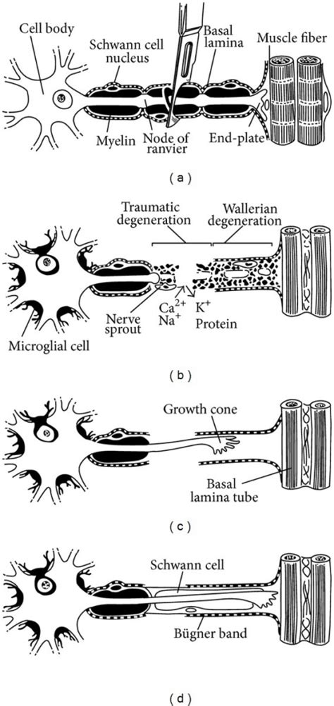 Peripheral Nerve Injury - The Operative Review Of Surgery