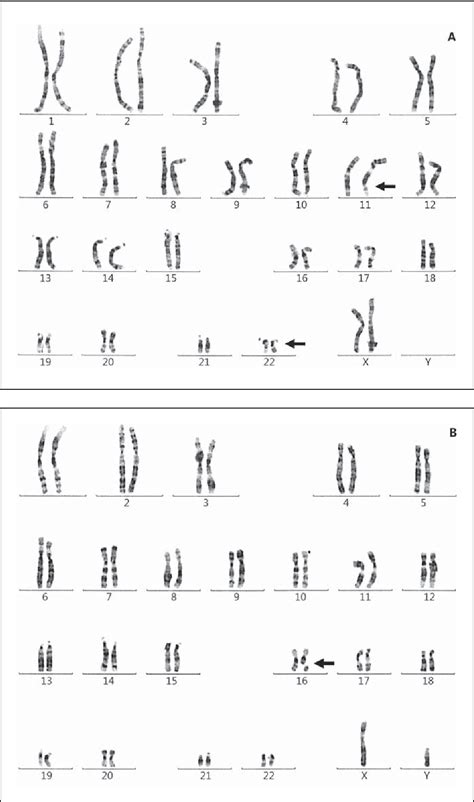 Chromosome 16 Abnormalities in Embryos and in Sperm from a Male with a Fragile Site at 16q22.1 ...