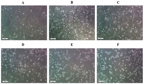 Morphology of A549 cells after a 24-h treatment with DMSO (A); 25, 50 ...