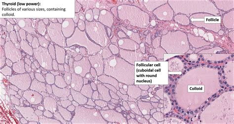 Thyroid – Normal Histology – NUS Pathweb :: NUS Pathweb