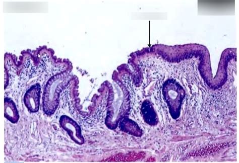 Histology- Recto-Anal Junction Diagram | Quizlet