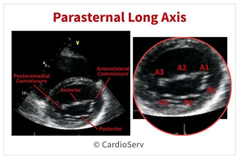 Finally... Mitral Valve Orientation Explained! Cardioserv