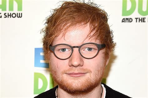 Ed Sheeran Addresses Face Scar, Jokingly Blames It on James Blunt