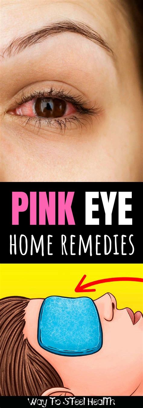 Get rid of pink eye fast with these 6+ home remedies | Natural pink eye ...