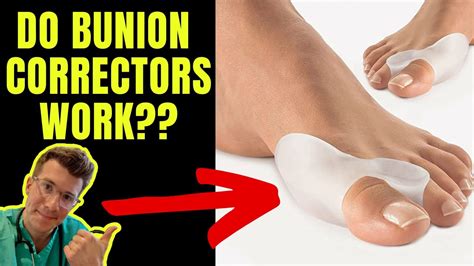 DO BUNION CORRECTORS WORK? Doctor explains... - YouTube