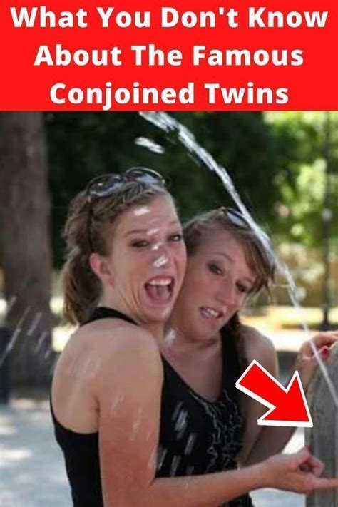 The story of abby and brittany hensel the famous conjoined twins – Artofit