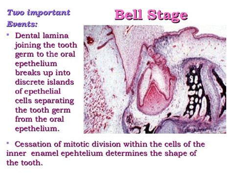 Amelogenesis - Stages of enamel formation