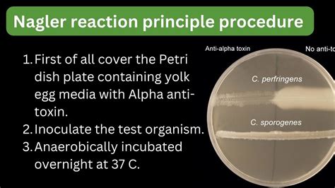 Clostridium perfringens Nagler reaction principle procedure ...