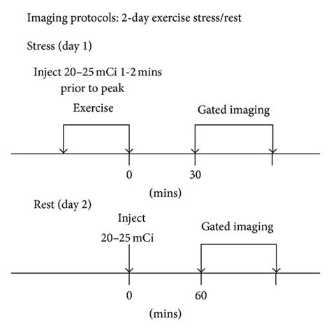 99mTc-N-DBODC5 and 99mTc-MIBI imaging protocols: two-day exercise ...