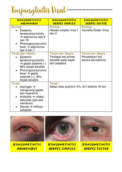 Konjungtivitas Vital, Konjungtivitas Sicca, Pendarahan Subkonjungtiva ...