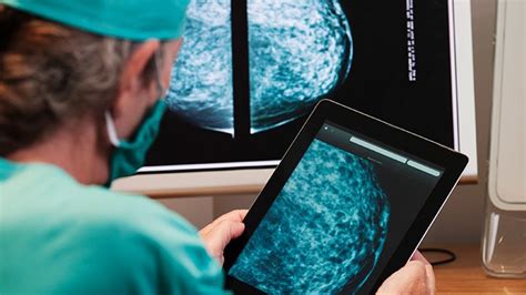 False-Positive Mammogram May Hint at Breast Cancer Risk Later ...