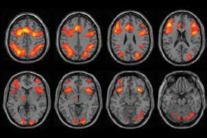 Coffee's effects revealed in brain scans | New Scientist