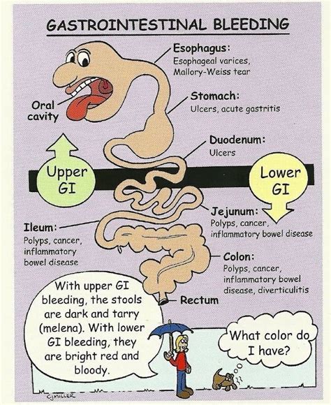 GI bleeds- paramedic nremt | Med surg nursing, Nursing school survival ...