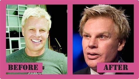 Mike Jeffries Plastic Surgery Before And After Mike Jeffries Plastic Surgery #Mi... - #Jeffries ...