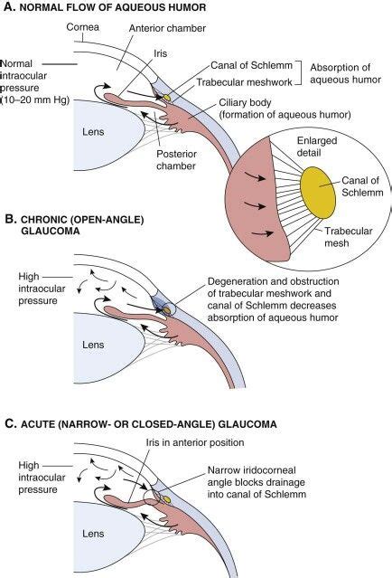 Trabecular Meshwork Anatomy